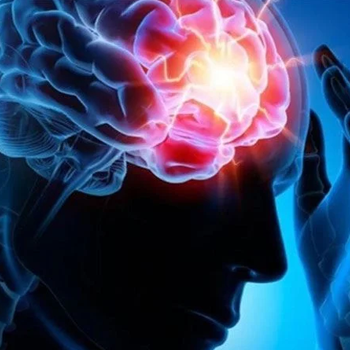 Epilepsi