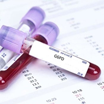 Glukoz 6 Fosfat Dehidrogenaz (G6PD) Enzim Eksikliği