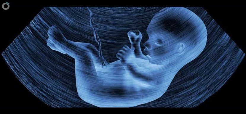 Fetal Dna testi (cffDNA) nedir?